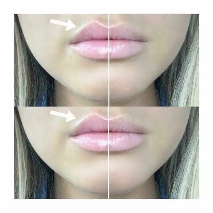 Плоский бант техника увеличения фото BRAND NEW** Nu Skin Lip Plumping Balm Lip plumping balm, Eyelash treatment, Lip 