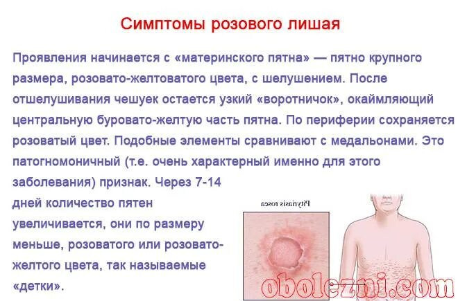 Плоский лишай фото у человека как выглядит Стригущий лишай у детей: о формах и лечении рассказывает опытный педиатр