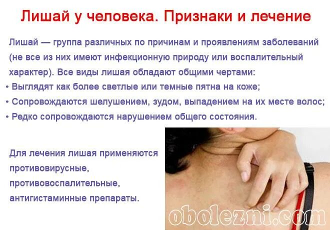 Плоский лишай фото у человека лечение Стригущий лишай у детей: о формах и лечении рассказывает опытный педиатр