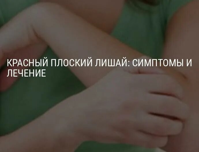Плоский лишай фото у человека лечение Красный плоский лишай слизистой рта и кожи, симптомы и лечение