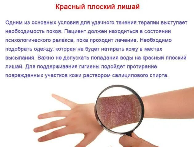 Плоский лишай на коже у человека фото Красный лишай - 90 фото и видео инструкции по лечению в домашних условиях