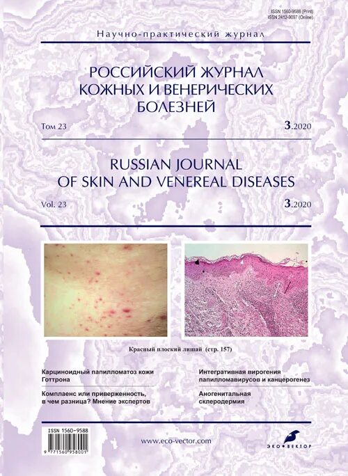 Плоский лишай вульвы фото Vol 23, No 3 (2020) - Russian Journal of Skin and Venereal Diseases