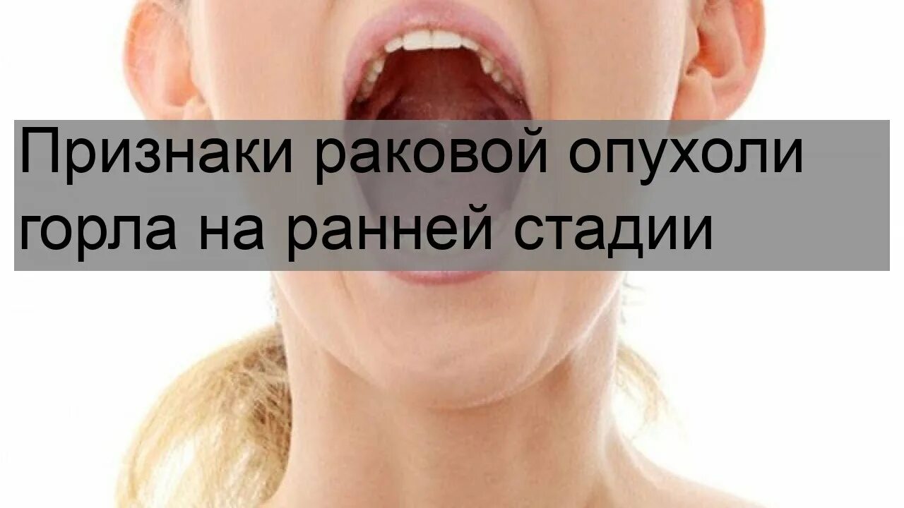 Плоский рак горла фото Признаки раковой опухоли горла на ранней стадии - YouTube