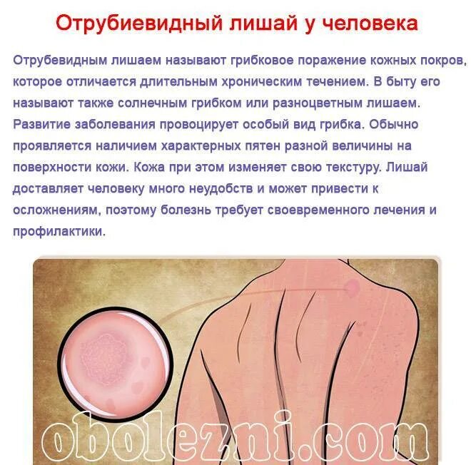 Плоский розовый лишай фото и лечение Чем лечить лишай у ребёнка: 6 основных принципов терапии