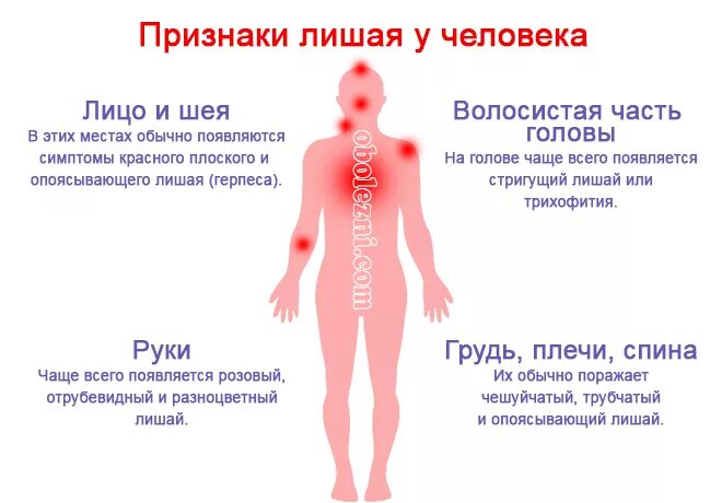 Плоский розовый лишай фото и лечение Розовый лишай у собаки: симптомы и лечение причины