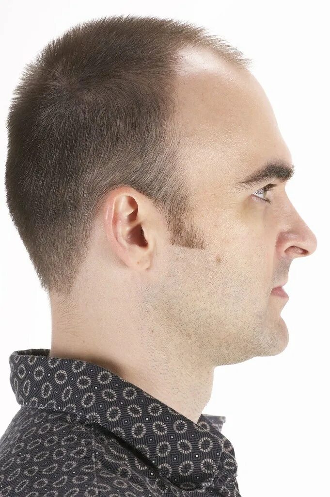 Плоский затылок прически мужские Face Turn Aorunds 007 Reference3D Professional Reference Material for 3D Artists