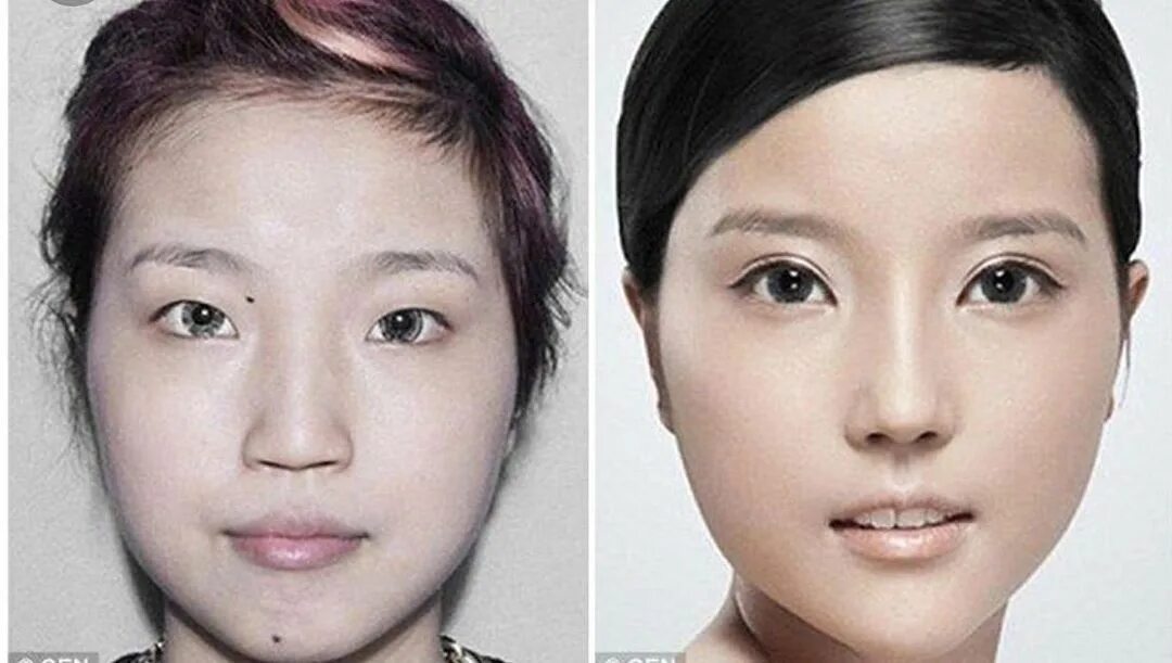 Плоское лицо фото chinese double eyelid surgery Cheaper Than Retail Price Buy Clothing, Accessorie