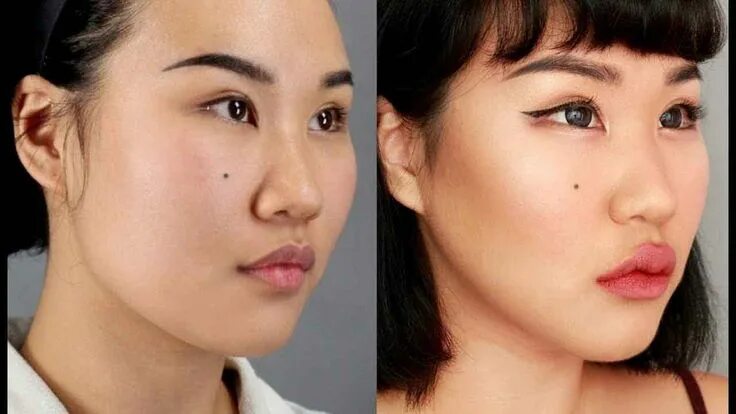 Плоское лицо фото Plastic surgery before and after nose korean 7 - Liposuction before and after Li