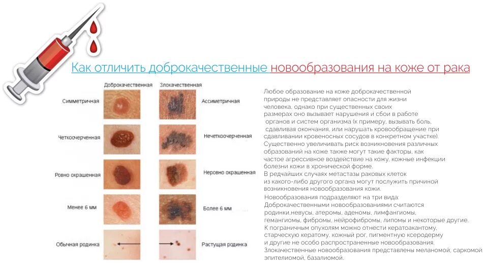 Плоскоклеточный рак кожи фото начальная стадия описание Рак кожи: меланома, базалиома и другие - 1 Августа 2018 - Земля - Хроники жизни