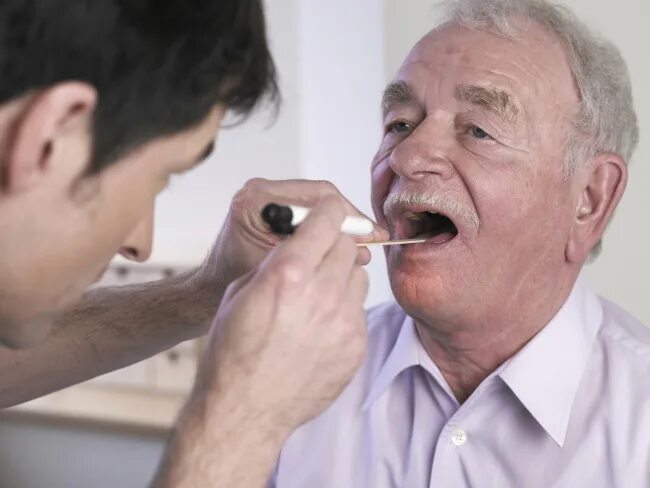 Плоскоклеточный рак языка фото симптомы и лечение Oral Mucositis: Chemotherapy-Associated Toxicity- Cancer Therapy Advisor