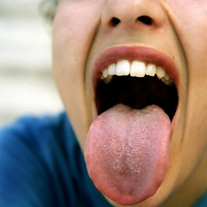 Плоскоклеточный рак языка фото симптомы и лечение Uni Is Gonads. Go Chew On That. HuffPost Life