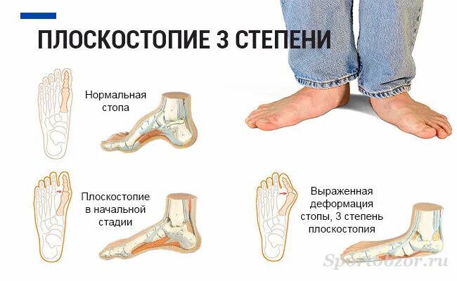 Плоскостопие симптомы у взрослых фото Panda Orto-fiz, medical center, clinic, Ferghana, Yuksalish Street, 93 - Yandex 