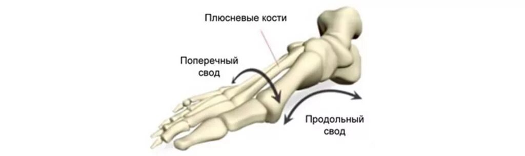 Плюсна это что такое фото Плоскостопие Медицинская клиника Панацея в Домодедово