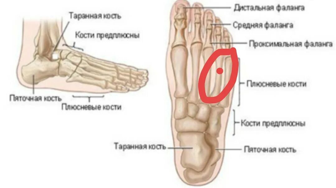 Плюсневая кость на ноге где находится фото Ответы Mail.ru: За сколько срастётся эта кость на ноге и как ускорить её срощени