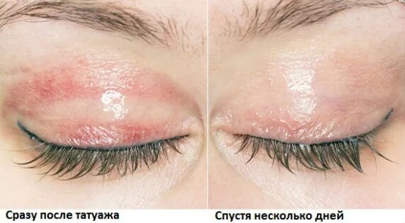 Плюсы и минусы татуажа межреснички Перманентный макияж межресничного пространства больно ли - Красота
