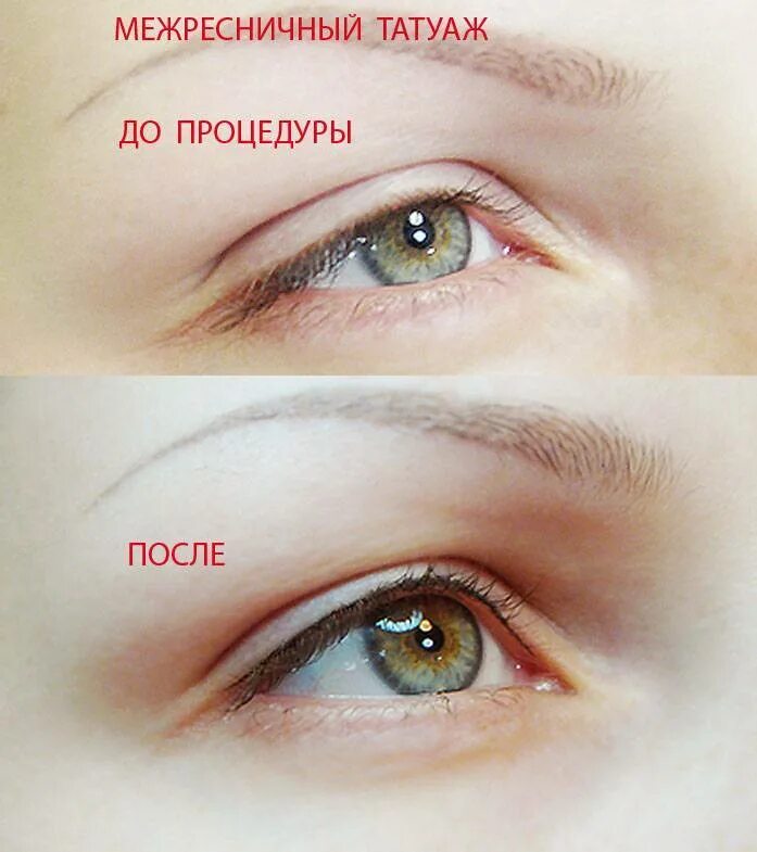 Плюсы и минусы татуажа межреснички Межресничка до и после Южный Город