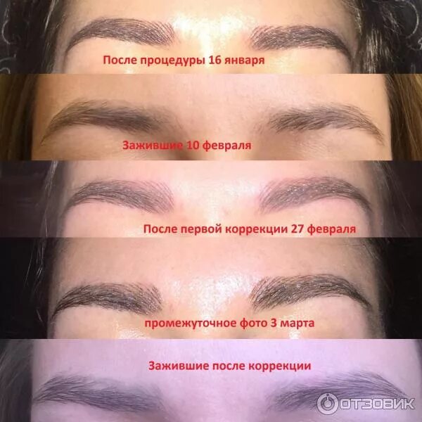 Пм бровей заживление по дням фото Отзыв о Микроблейдинг бровей Лично мне не подошла процедура.