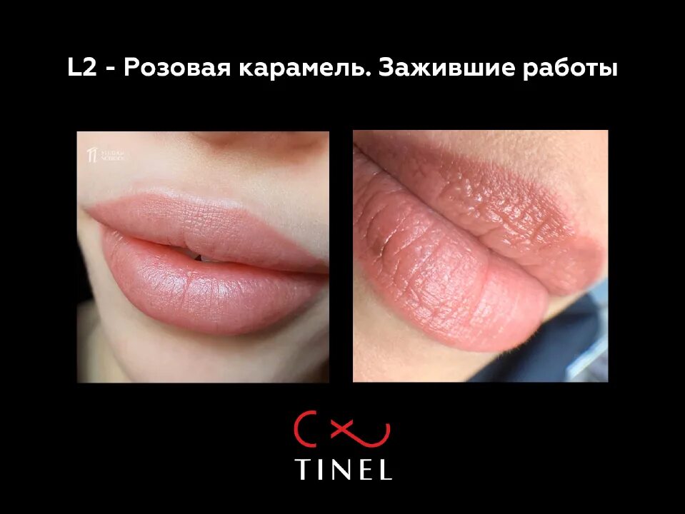 Пм губ крем карамель фото L2 - пигмент Tinel "Розовая карамель" для перманентного макияжа губ 5мл (id 8991