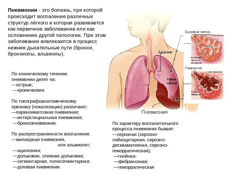 Пневмония как выглядит фото Картинки ВОСПАЛЕНИЕ ЛЕГКИХ БЕЗ ЛЕЧЕНИЯ