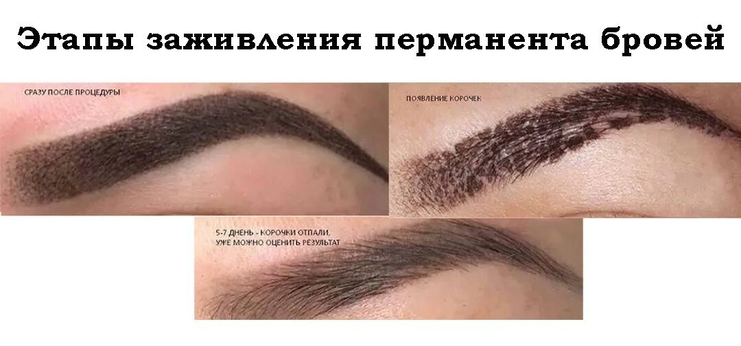 По дням после татуажа бровей Этапы перманента бровей