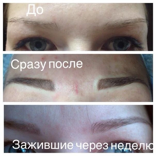 По дням после татуажа бровей Бровки Натюрель. Фотография из альбома Мои работы - 20 из 59 ВКонтакте