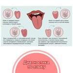 По фото определить состояние здоровья Диагноз по языку в картинках определение