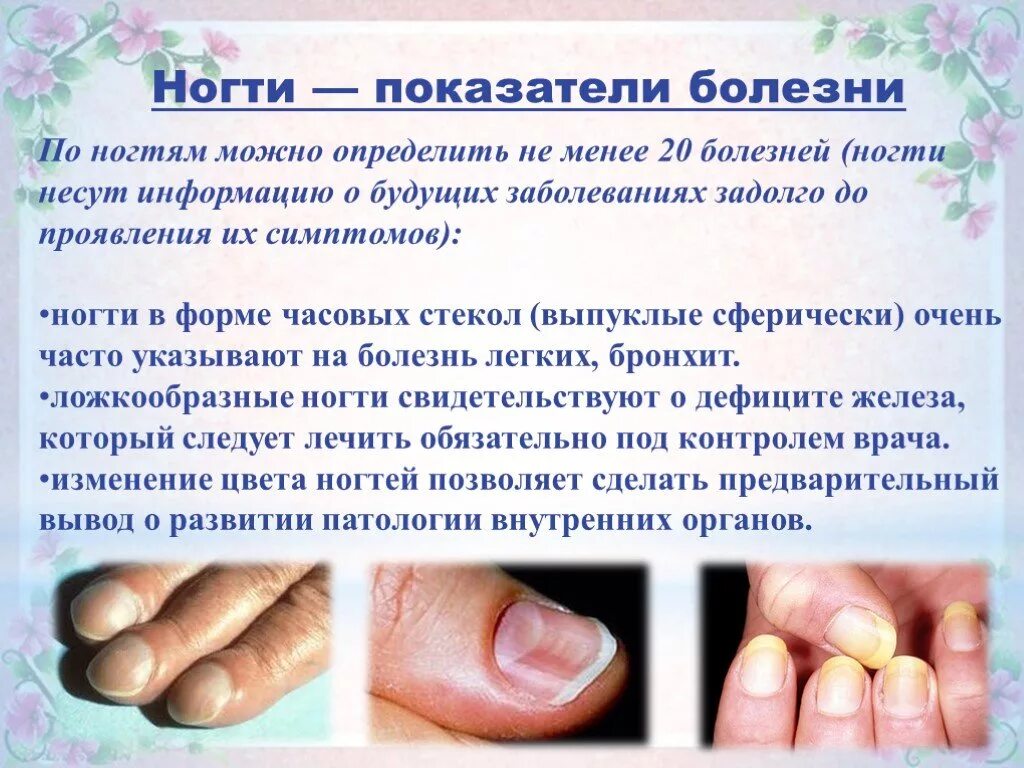 По фото определить заболевание ногтей Виды грибков ногтей и причины их возникновения