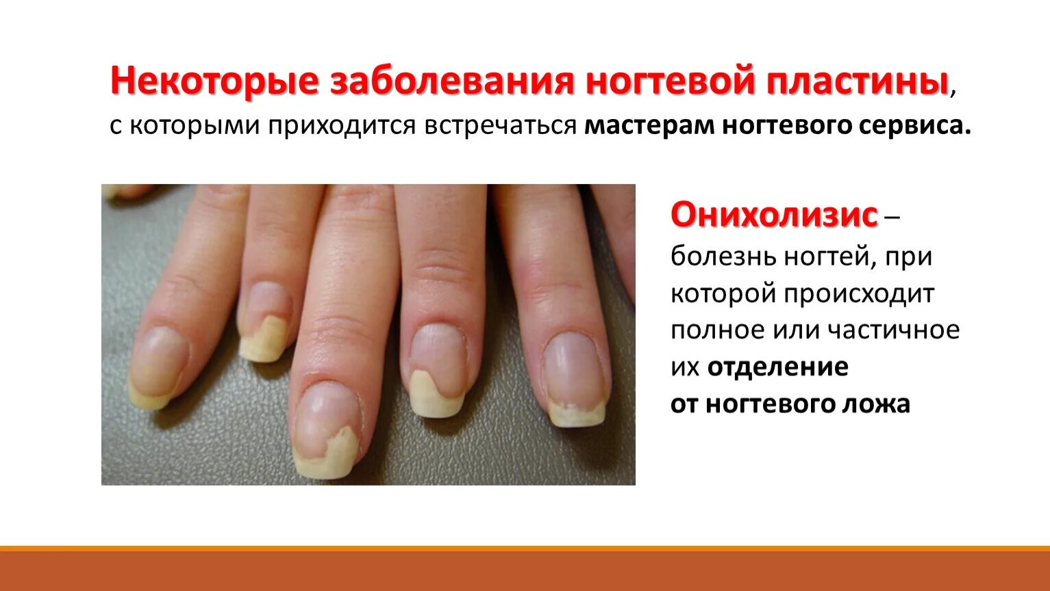 По фото определить заболевание ногтей Презентация к лекции "Болезни ногтей. Бородавки и маникюр" для студентов специал