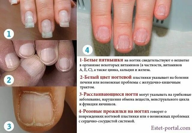 По фото определить заболевание ногтей ПОЛЕЗНЫЕ СОВЕТЫ - Разное OK.RU