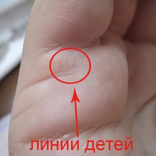 По линии руки онлайн по фото СКОЛЬКО БУДЕТ ДЕТЕЙ? - 1 ответов форум Babyblog