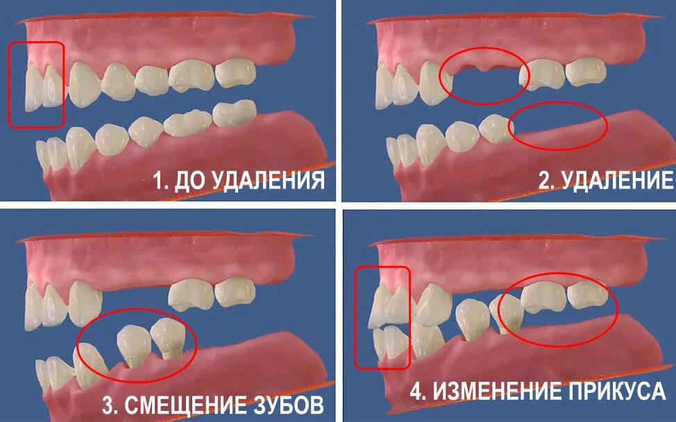 Почему бывшие удаляют фото Дантист - Имплантация