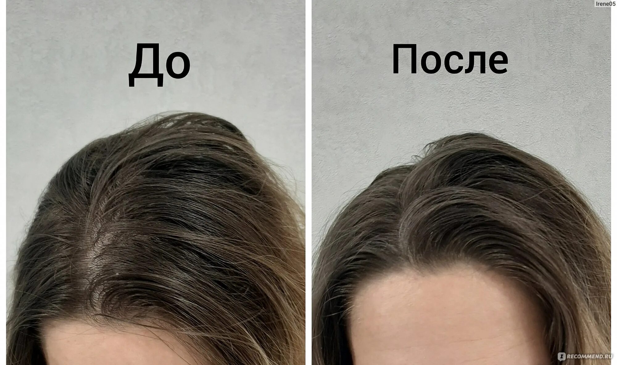 Почему чистые волосы выглядят как грязные Сухой шампунь Girlz Only Для жирных и тусклых волос Dawn Till Dusk Dry Shampoo -