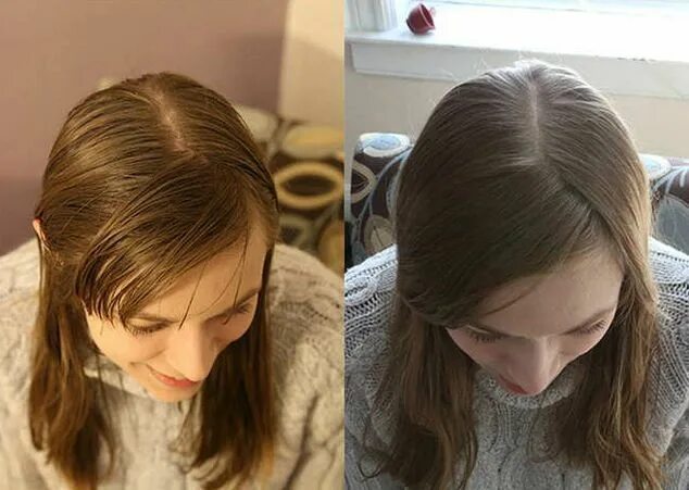 Почему чистые волосы выглядят как грязные волосы Hair without shampoo, Hair beauty, Beauty