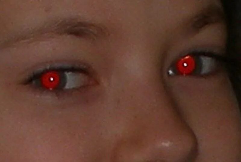 Почему на фото красные глаза Из-за каких факторов появляется эффект красных глаз, как его убрать разными спос
