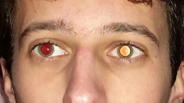 Почему на фото красные глаза Nøjagtighed voldgrav Hæderlig red eye reflection offer bind Skrivemaskine