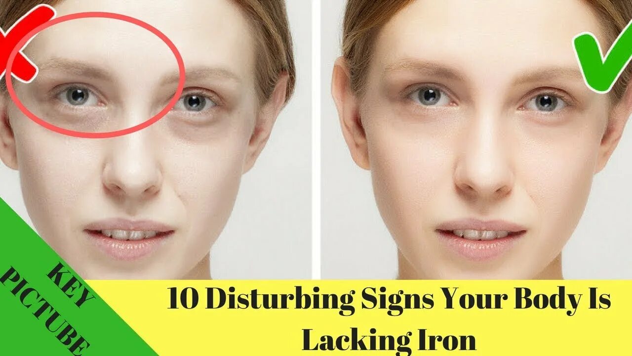 Почему на фото лицо 10+ Disturbing Signs Your Body Is Lacking Iron - YouTube