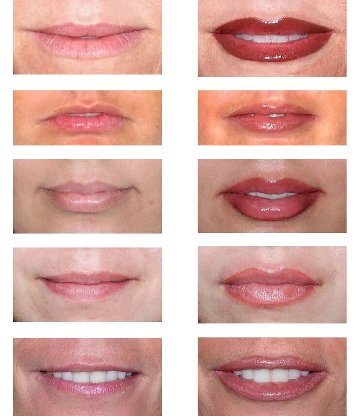 Почему перманентный макияж губ Before & After- Permanent Lip Makeup . Permanent makeup eyeliner, Lip permanent 