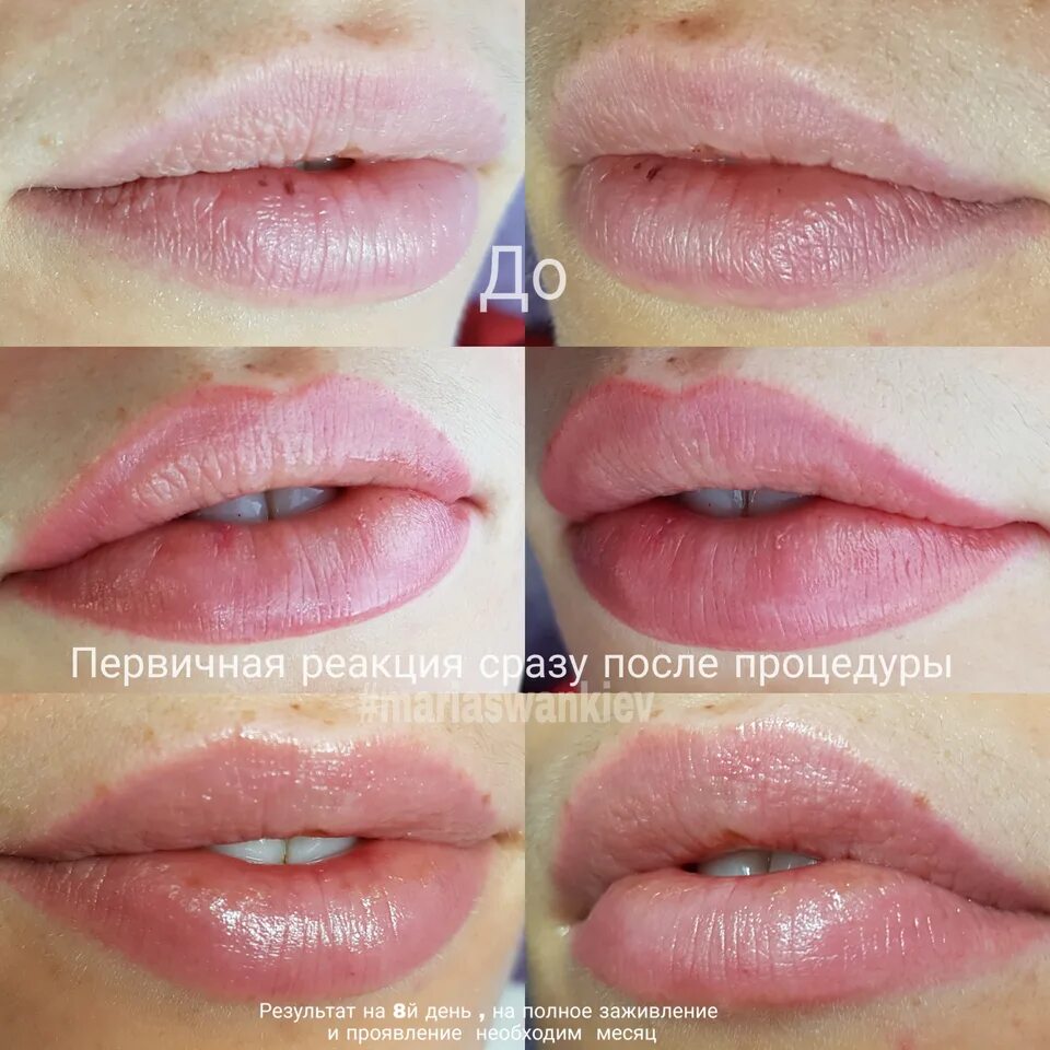 Почему перманентный макияж губ через неделю смылся Как заживает перманентный макияж губ: длительность