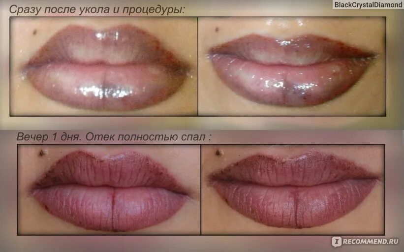 Почему перманентный макияж губ через неделю смылся Татуаж губ - "Забудьте о помадах! Раз и навсегда!))" отзывы