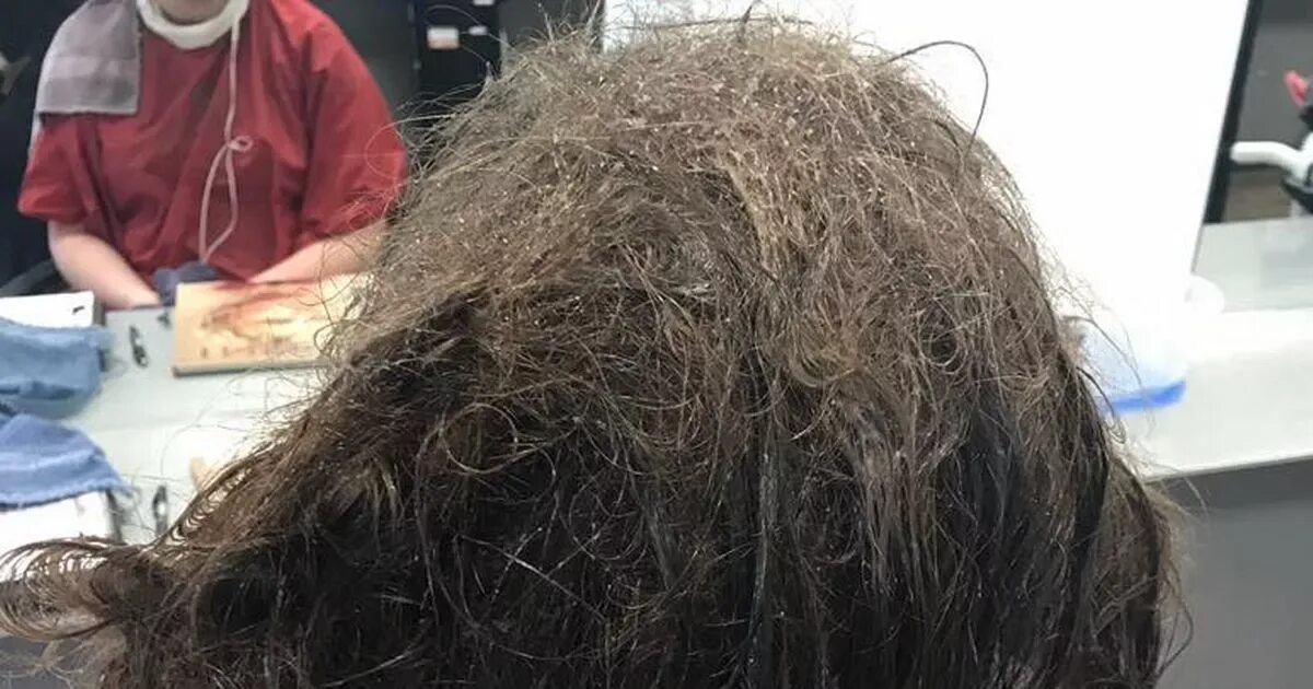 Почему помытые волосы выглядят как грязные Hairdresser refuses to shave depressed teen's matted hair for school pictures an