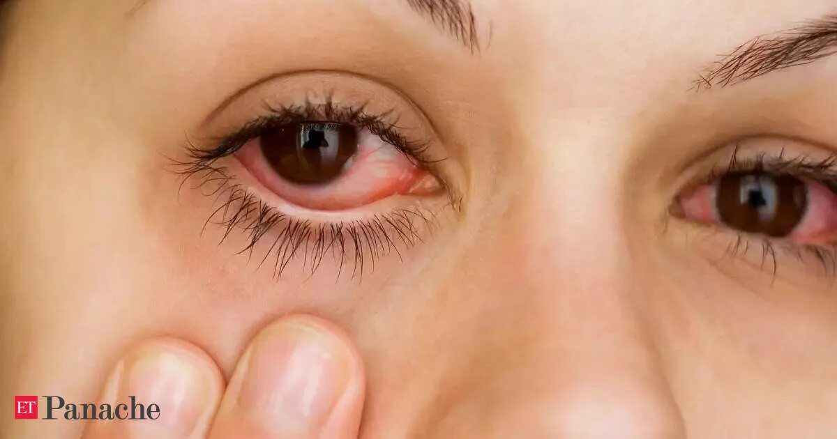 Почему после макияжа слезятся глаза ocular disease: Spike in conjunctivitis cases causes alarm; here's how you can s