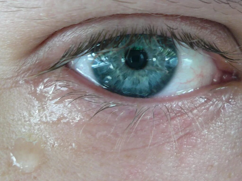 Почему после макияжа слезятся глаза Day 56 - Watery eye According to the doctor, I have some k. Flickr