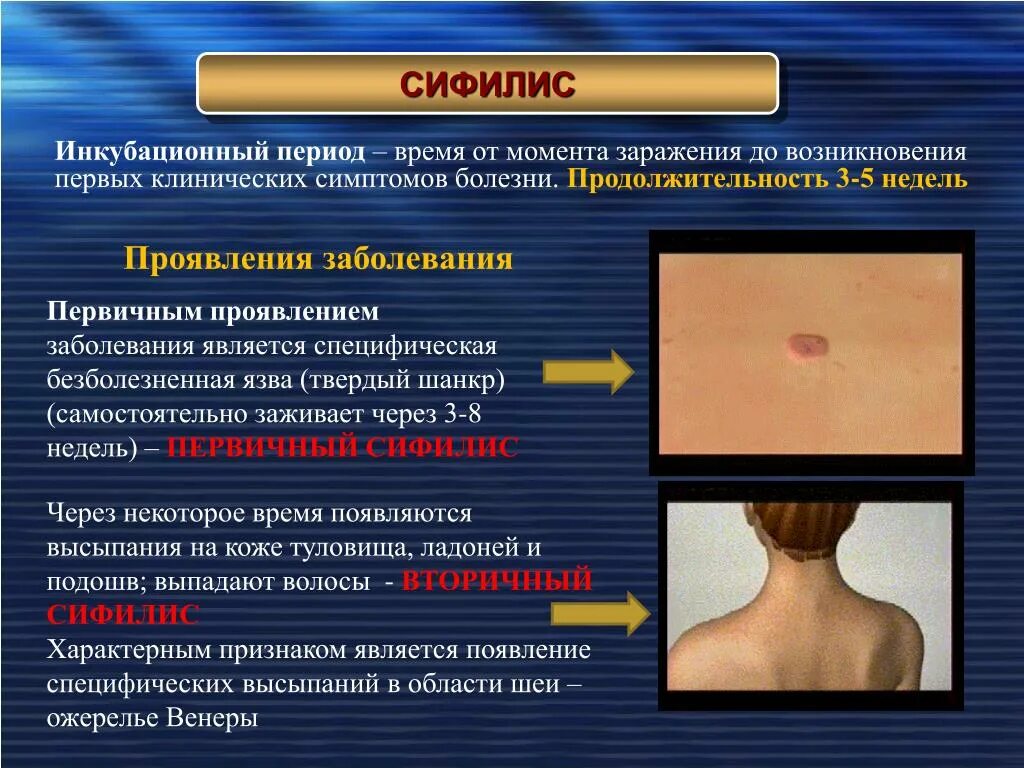 Почему симптомы фото Причины возникновения заболеваний у лиц: найдено 83 изображений