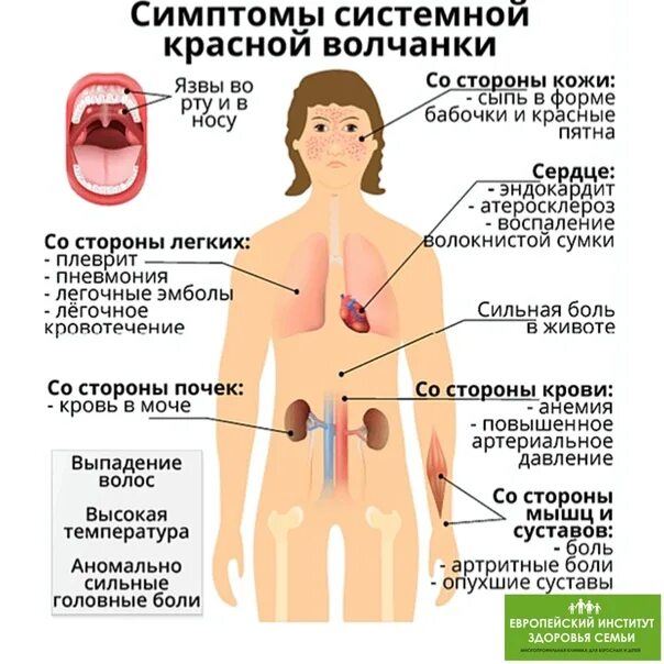 Почему симптомы фото Системные симптомы