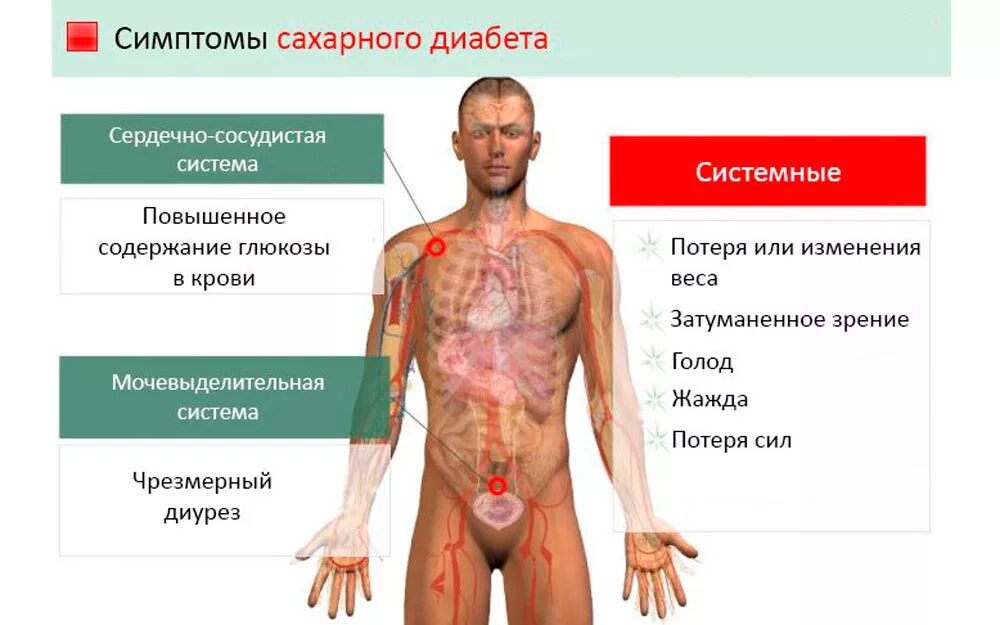 Почему симптомы фото Симптомы сахара у мужчин