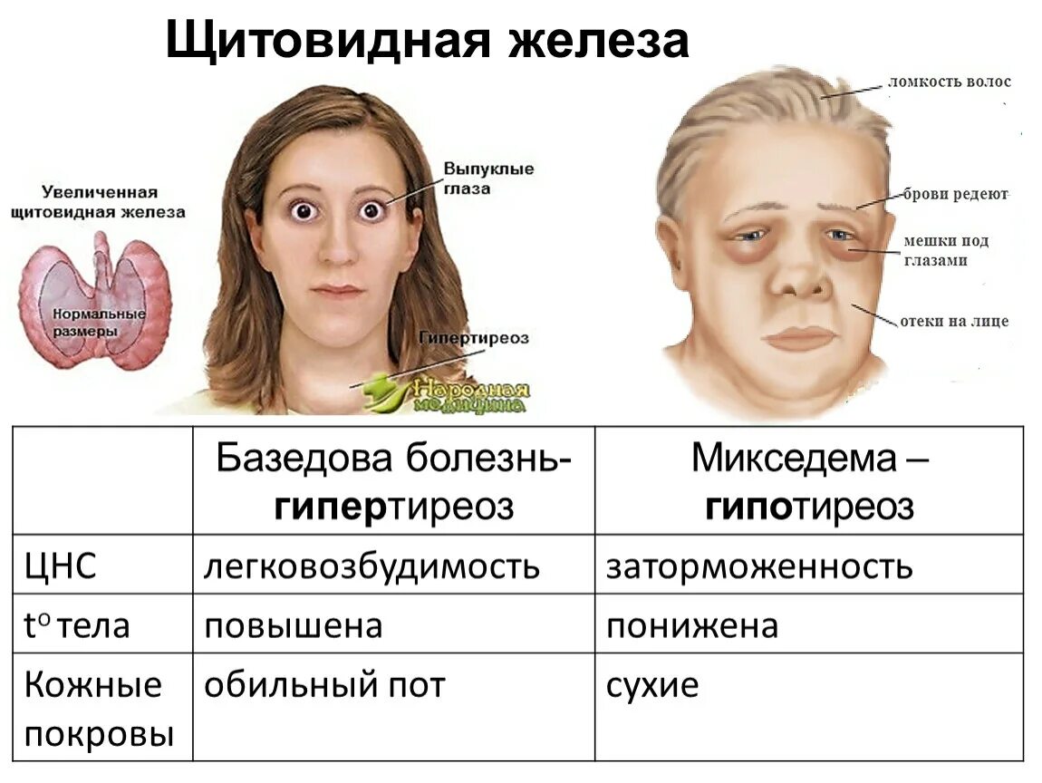 Почему симптомы фото Щитовидная железа признаки заболевания у мужчин: найдено 83 изображений