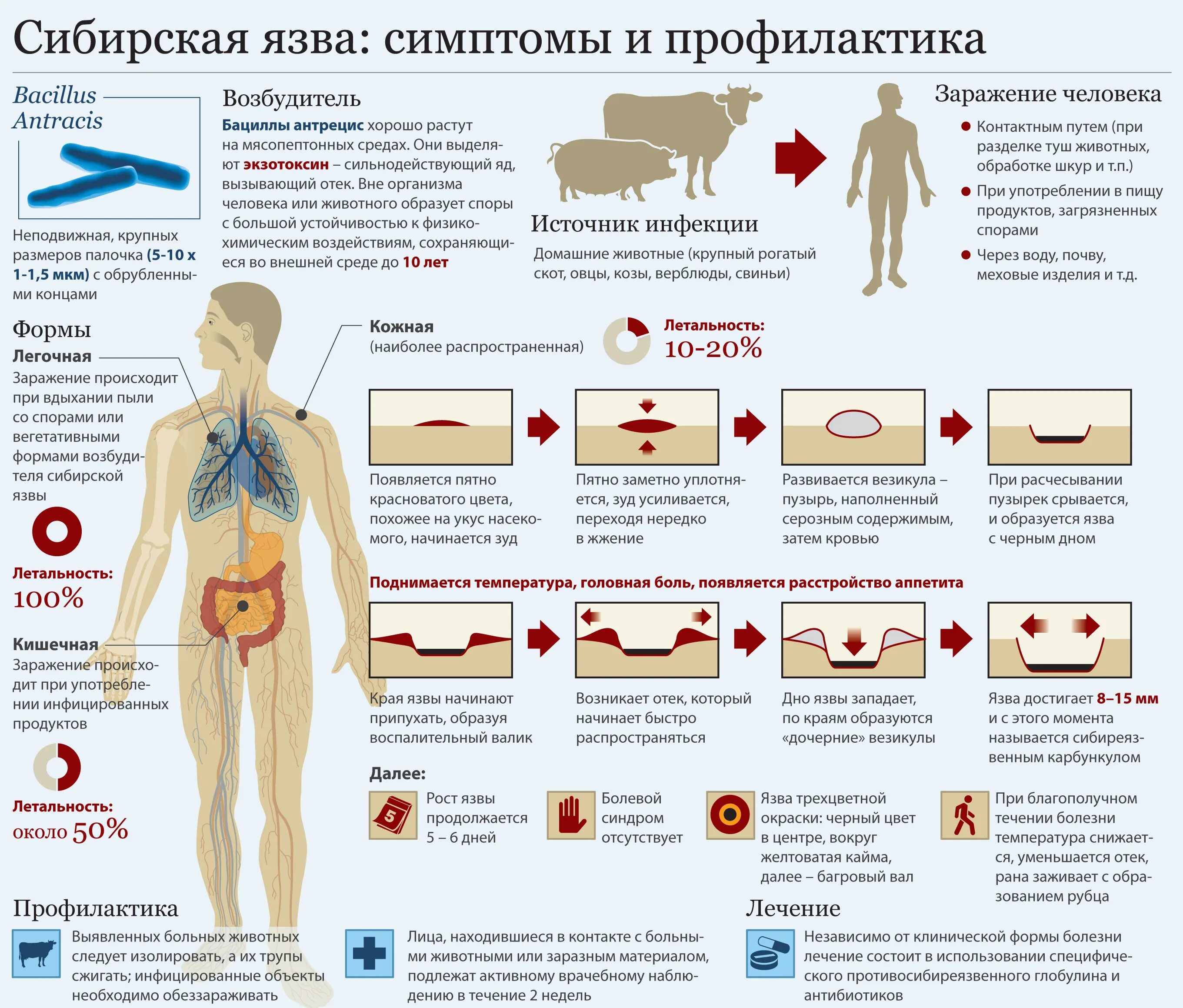 Почему симптомы фото Картинки ХОЛЕРА ЛЕЧИТСЯ ИЛИ НЕТ