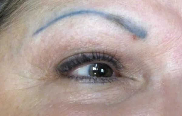 Почему синеет перманентный макияж бровей Bad Permanent Makeup an example of bad permanent makeup done by a technician who