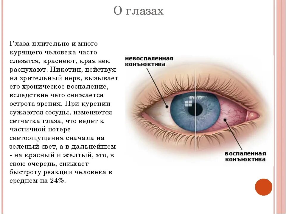 Почему слезятся глаза от макияжа Ребенок температура слезятся глаза