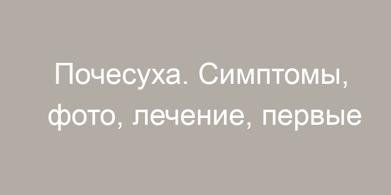 Почесуха фото симптомы Почесуха. симптомы, фото, лечение, первые признаки у взрослых, беременных, детей